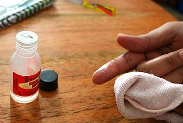 Удаление суперклея с кожи Попавший на руки цианакрилат нужно смыть ацетоном