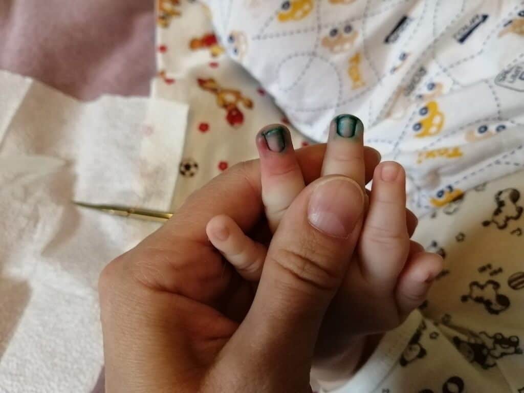 Как быстро отмыть зеленку с кожи, линолеума, одежды, мебели и других поверхностей